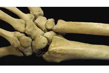 Oynar Eklemler Özellikleri ve Faydaları Nelerdir?